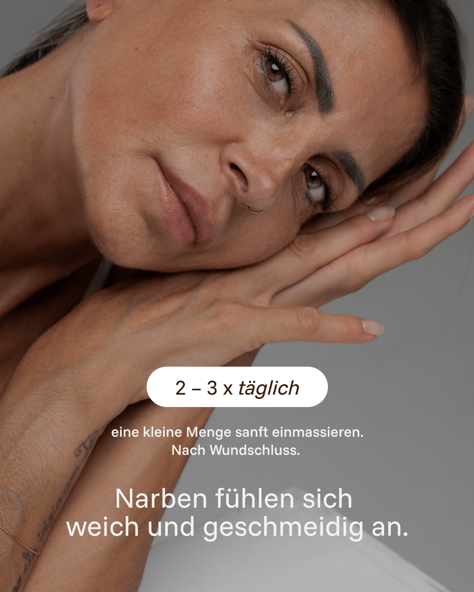 SCAR CARE FORMULA NARBENCREME - Healyni