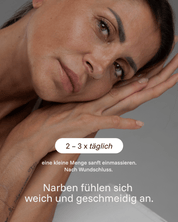 SCAR CARE FORMULA NARBENCREME - Healyni