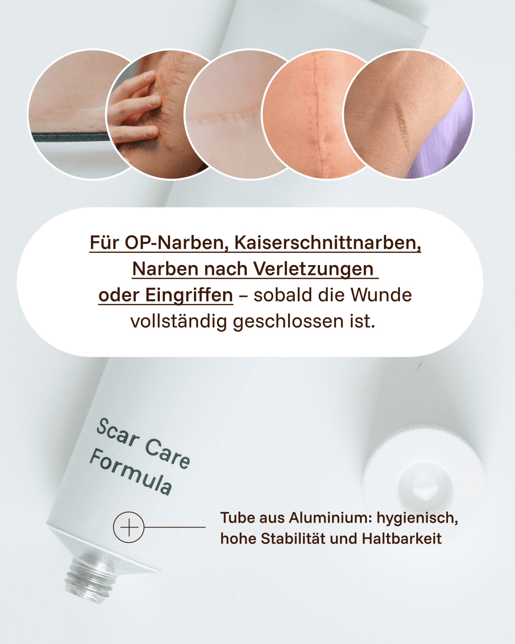 SCAR CARE FORMULA NARBENCREME - Healyni
