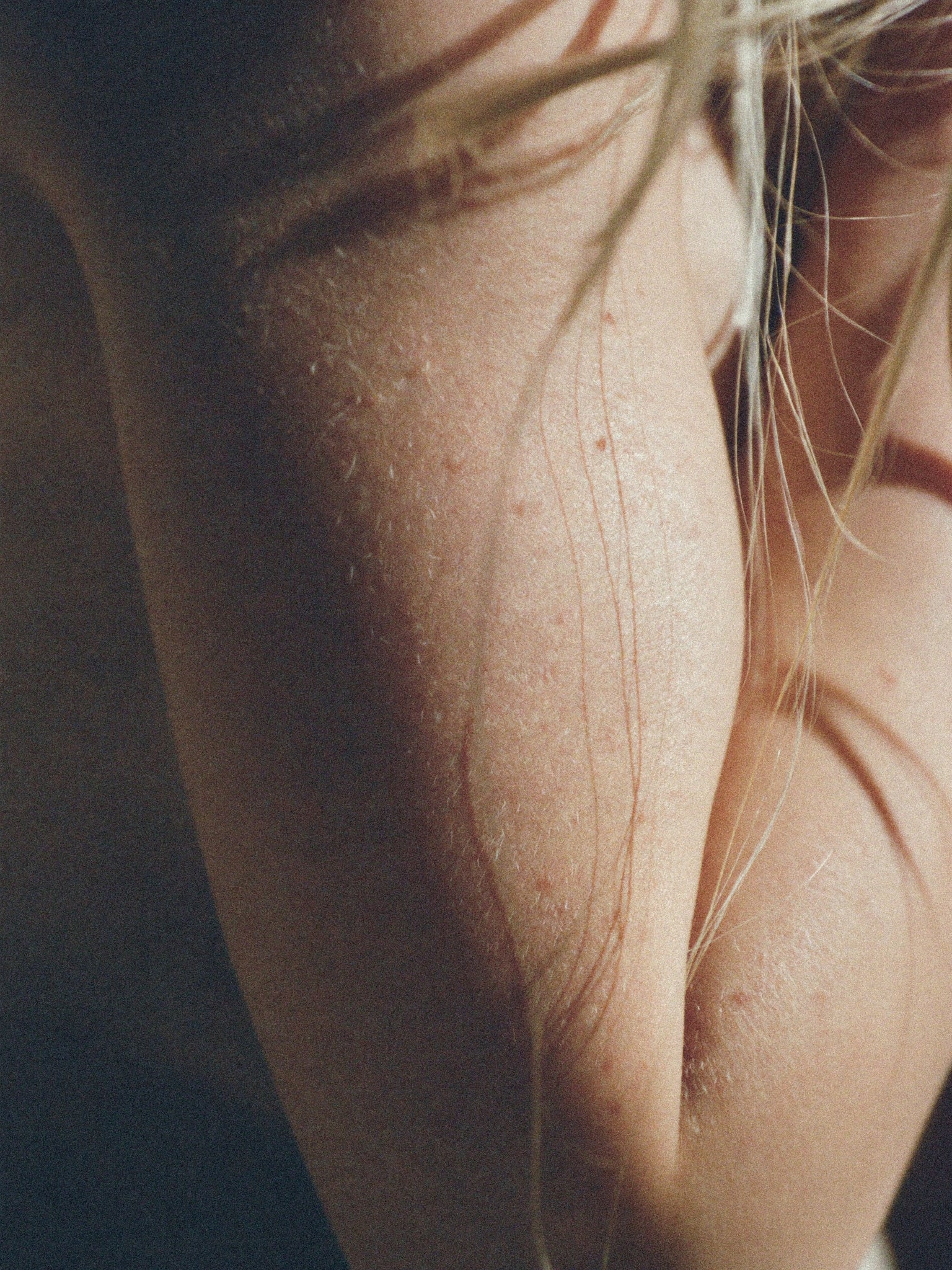 skin-shoulder-scarcare-narbe.jpg
