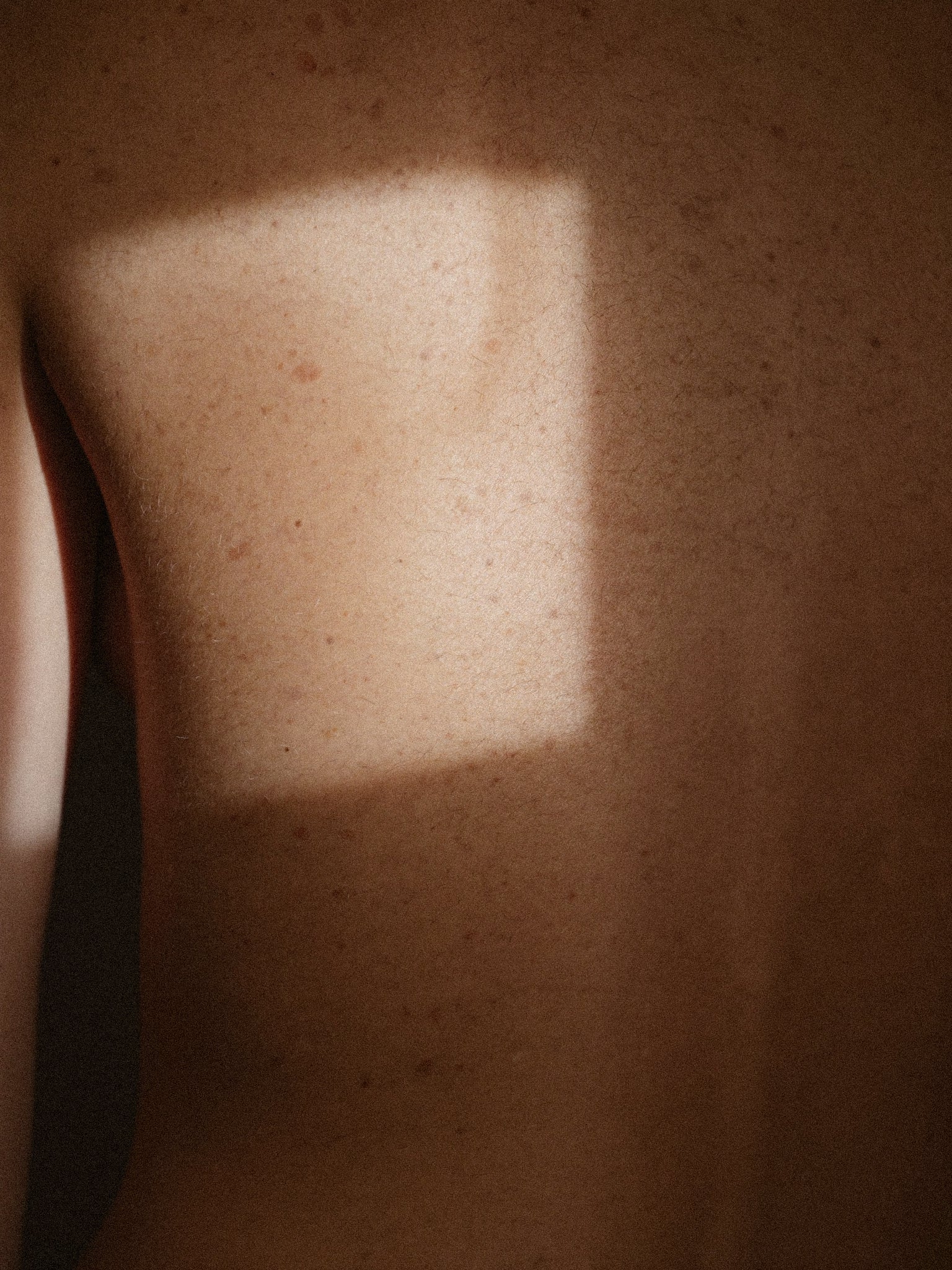 skin-sun-scar-narbenpflege.jpg